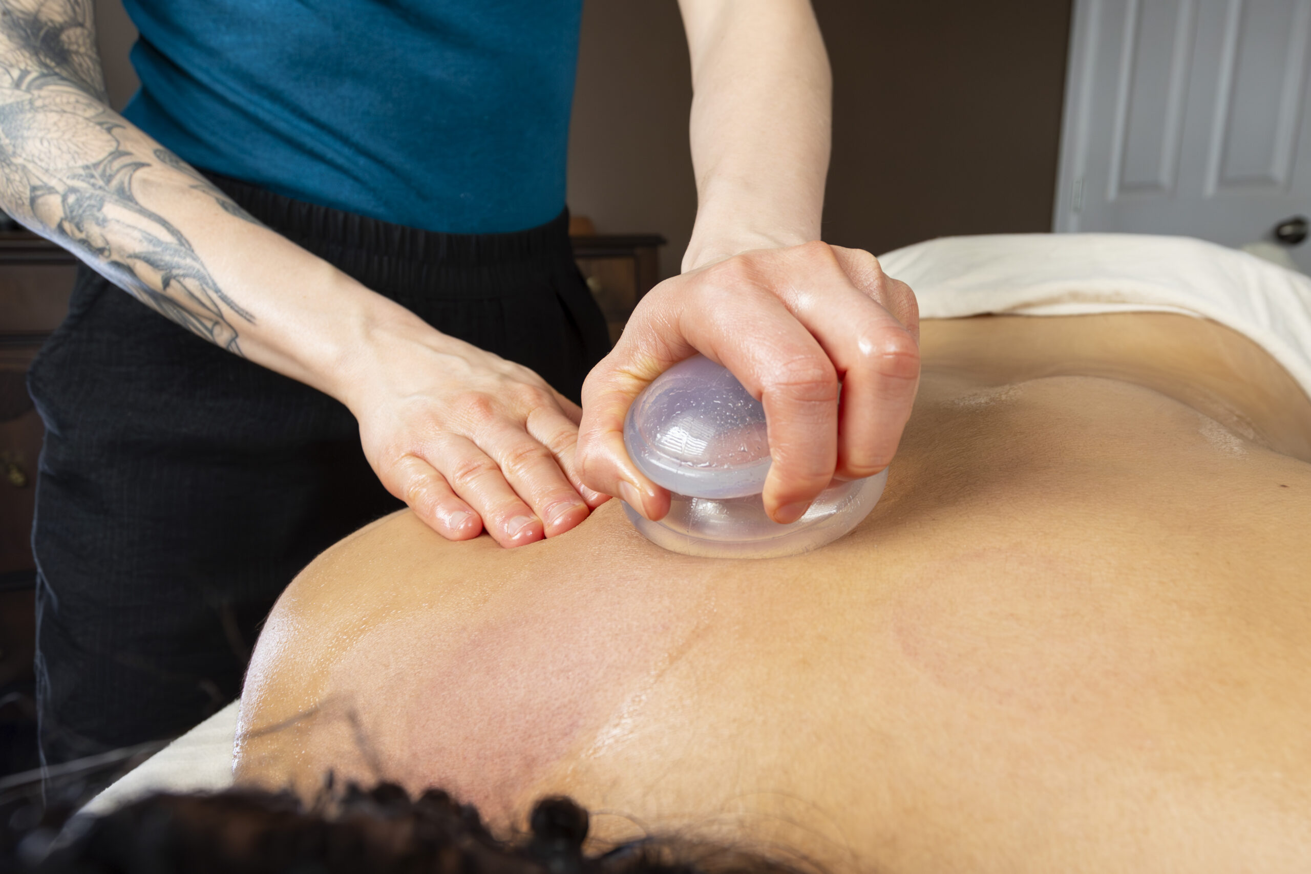Massage Therapy Cupping
